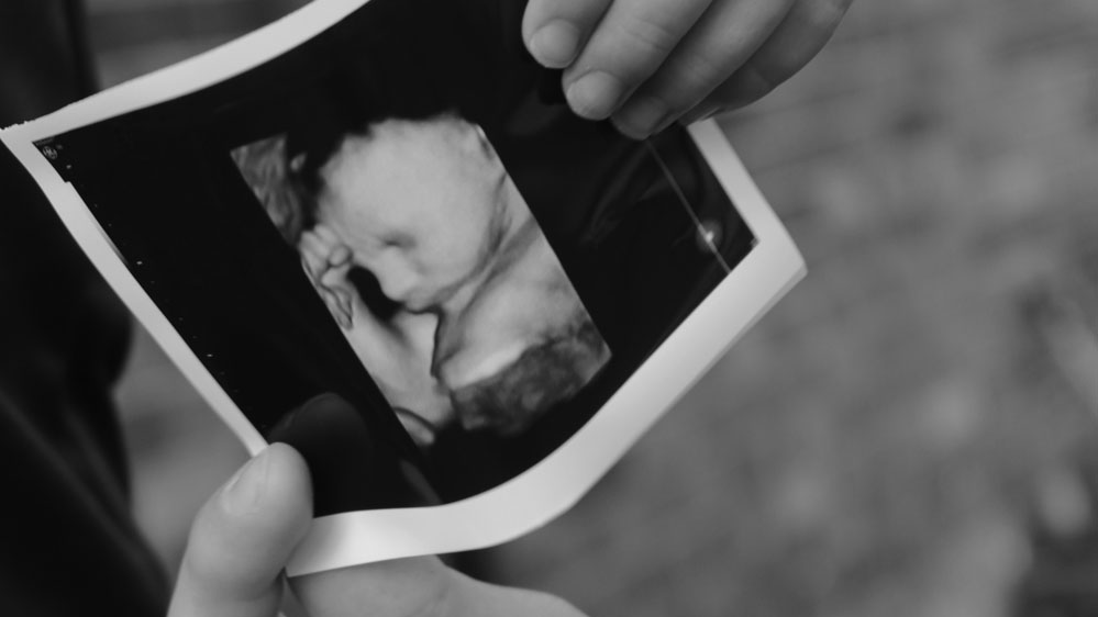 My Personal Perspective of Labor and Delivery